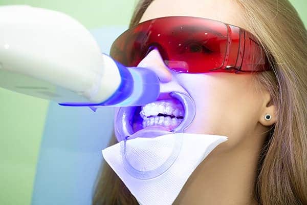 Laser teeth whitening treatments Bracknell