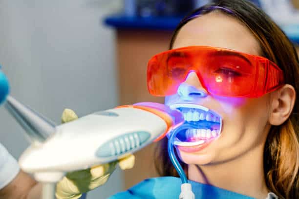 Simplifying Teeth Whitening: A Comprehensive Guide Bracknell