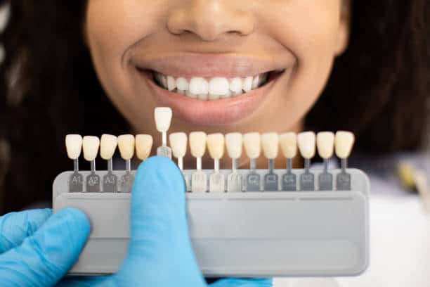 Laser Teeth Whitening: Exploring the Longevity of Your Brighter Smile Bracknell