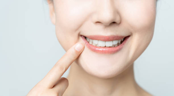 Comparing the Pain Factor: Laser Teeth Whitening vs. Zoom Teeth Whitening Bracknell