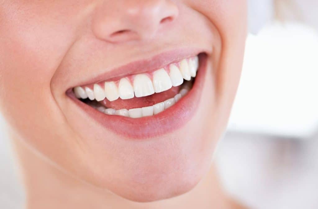 Teeth Whitening West Drayton Bracknell