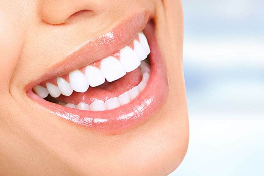 Teeth Whitening Abingdon Bracknell